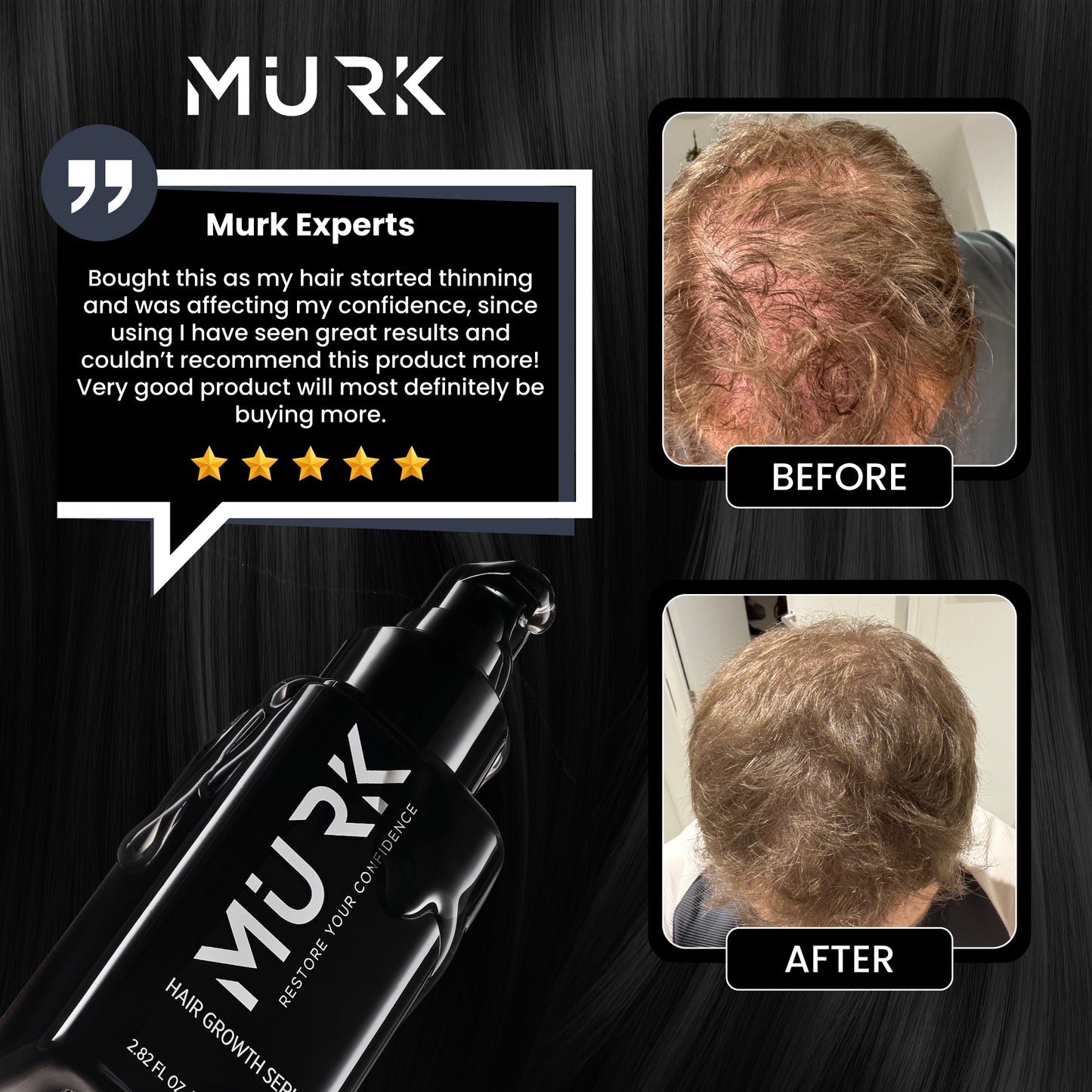 Hair Growth Kit