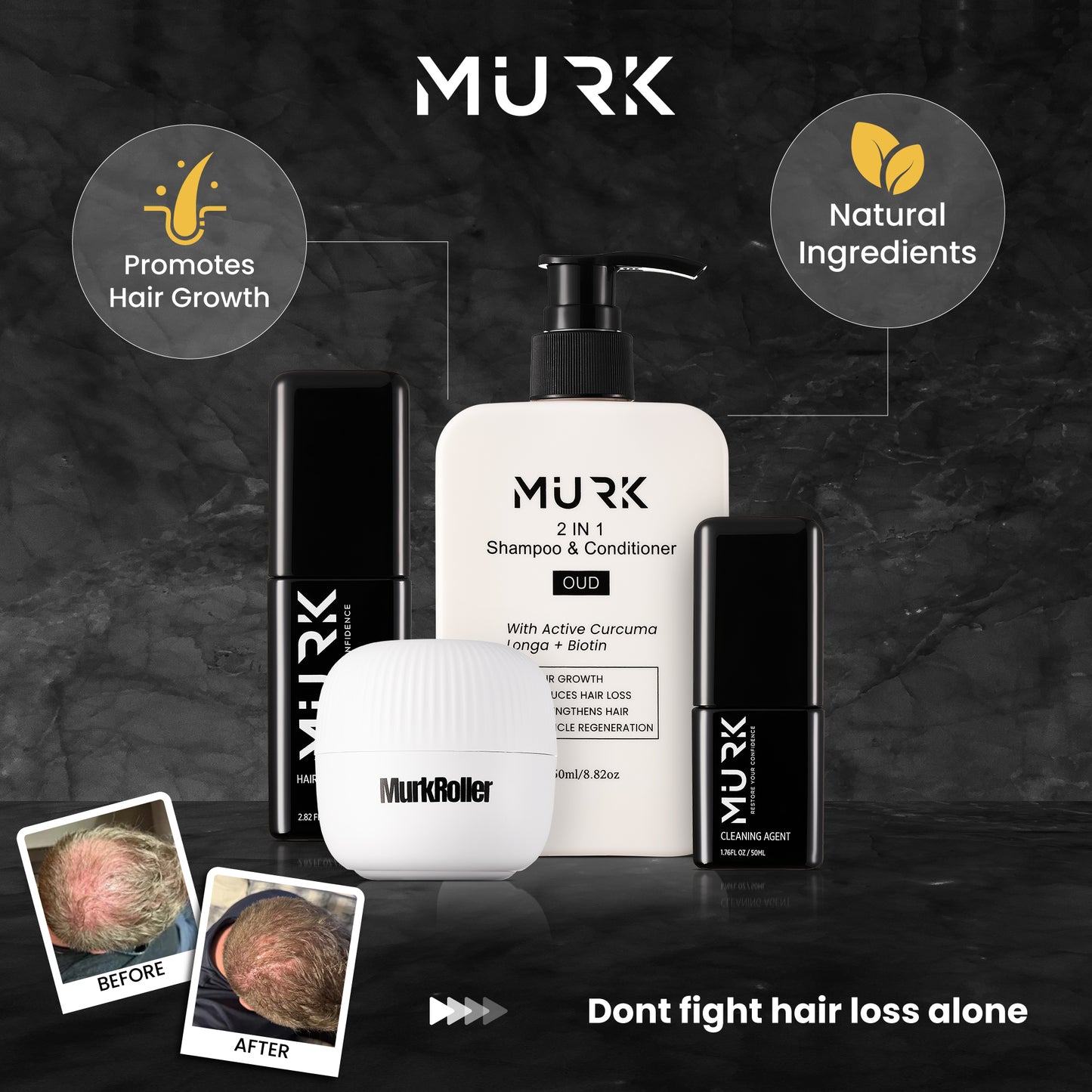 Hair Growth Kit